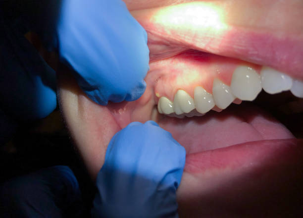 Urgent Tooth Repair in MA